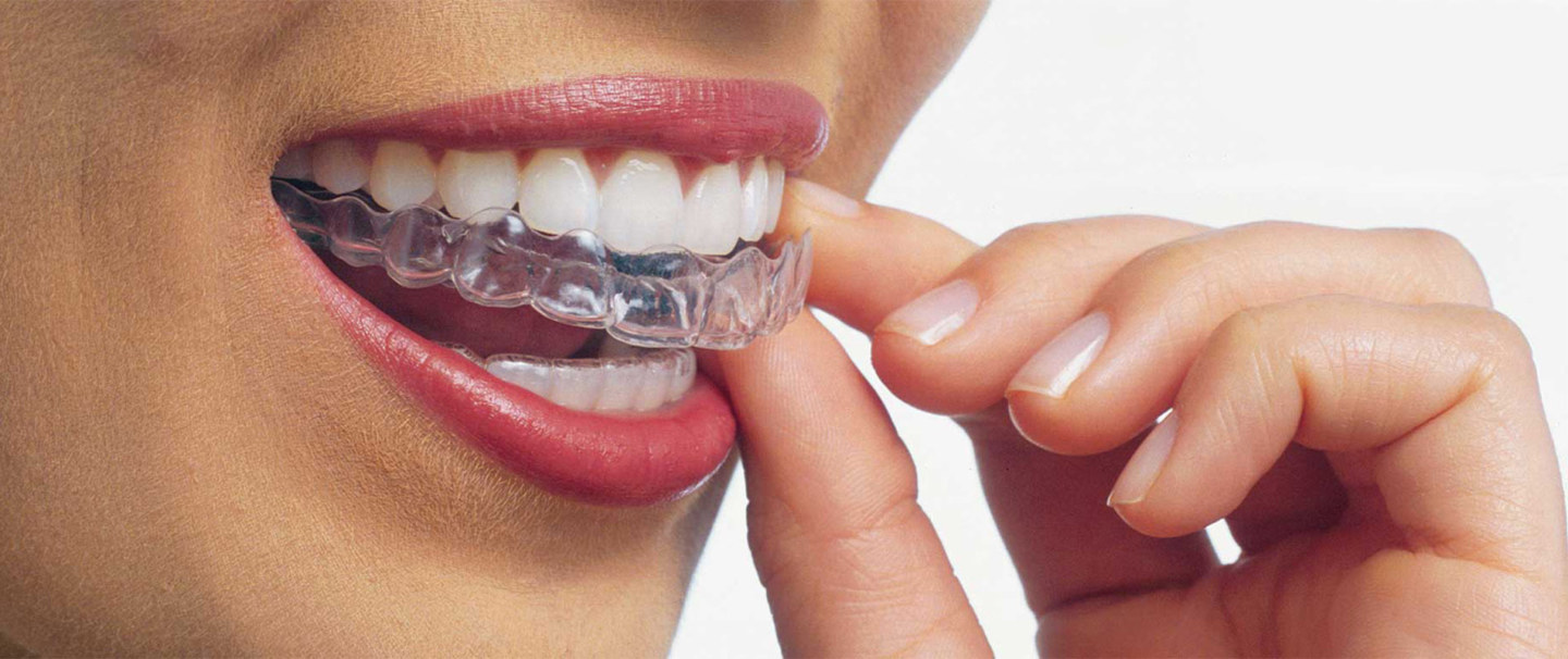Blog Stomatologia Dr. Ungureanu